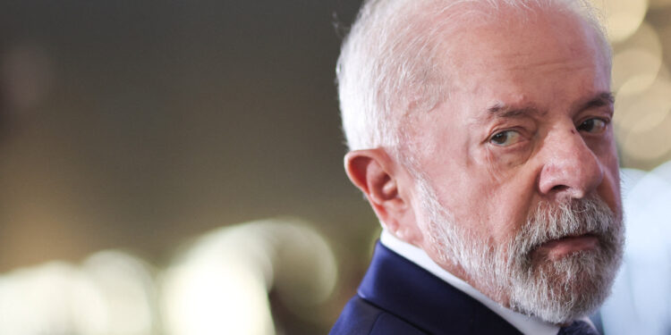 O que se sabe sobre a doença do Lula no couro cabeludo